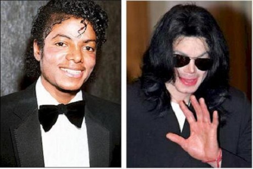 Michael Jackson przed i po zabiegach